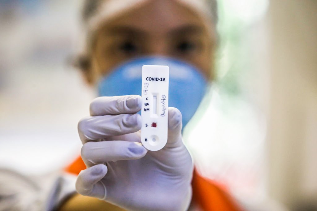 The City of Niteroi Conducts Rapid Testing of Patients Suspected of Being Infected With Coronavirus (COVID ñ 19)