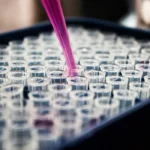 Estudo mostra que inflamação no cérebro pode ser chave do Alzheimer